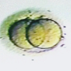 2 Cell Embryo on Day 1