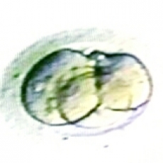 3 Cell Embryo on Day 1-2