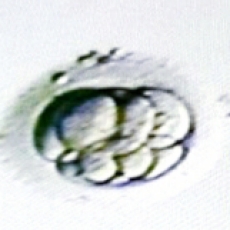 6-8 Cell Embryo on Day 3